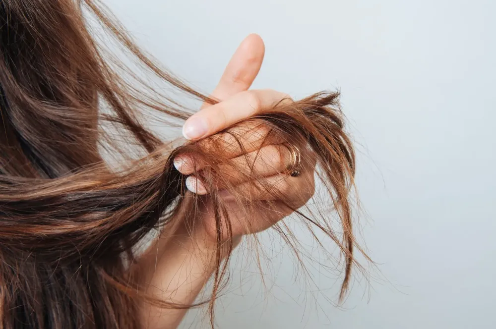 Perte de cheveux