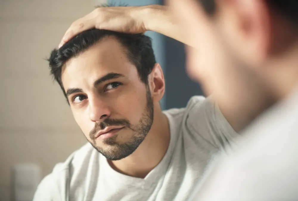 Perte de cheveux homme