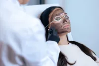 Hollywood Peel