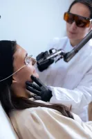 Hollywood Peel