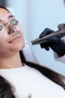 Hollywood Peel